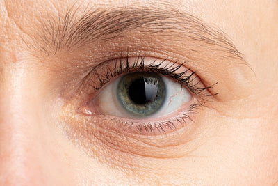 HOW TO STOP FINE LINES UNDER EYES FROM GETTING WORSE?